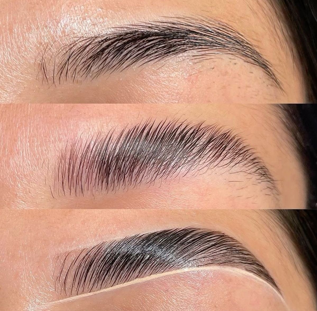 Brow Lifting Ergebnis