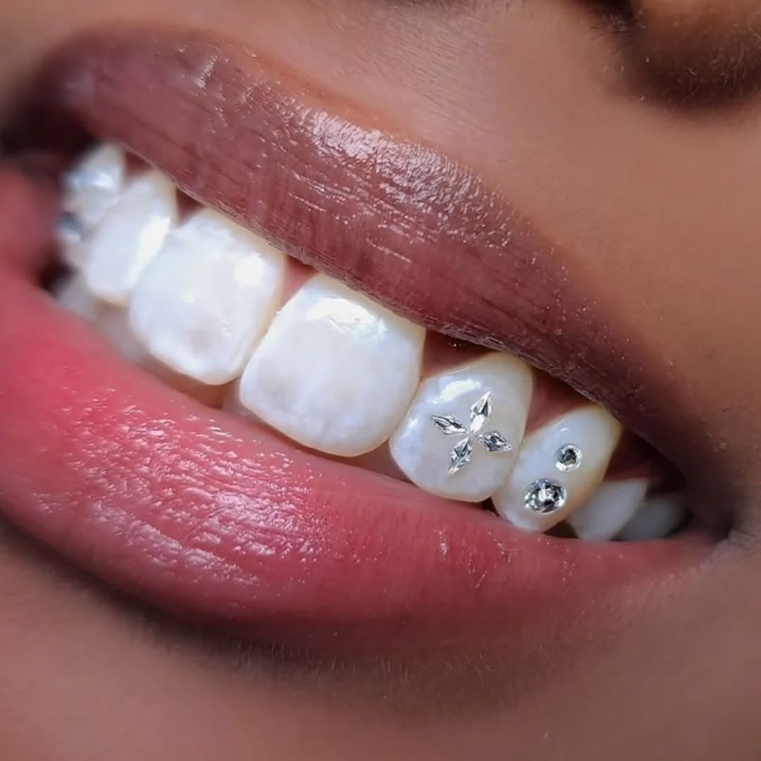 Tooth Gem mit Swarovski Steinen